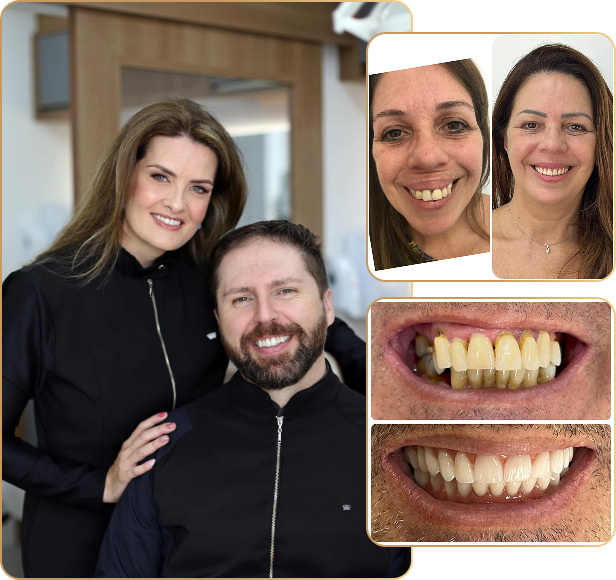 especialistas em Implantes Dentários